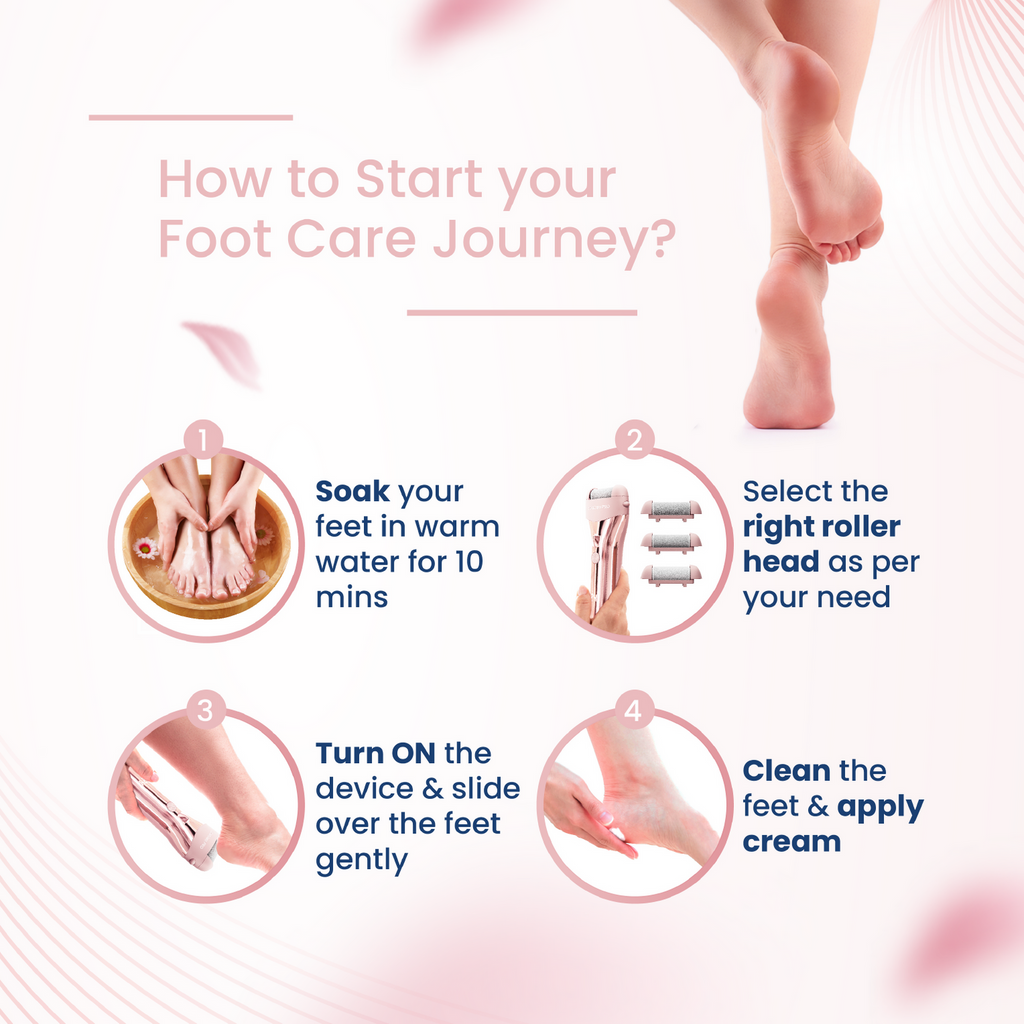 MamaFit callus remover